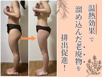 ヨサパーク 温美(YOSA PARK)の写真/痩せづらいお悩みを根本改善に特化した痩身メソッドで結果出し「よもぎで蒸されて痩身」よもぎ蒸し×リンパ