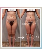 ボーテ ドゥ ランジュ(BEAUTE DE L’ANGE.)/◆痩身◆