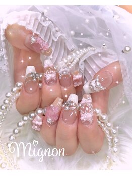 ミニョン 新宿(Mignon)/ガーリーネイル♪