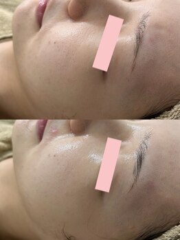 ビビィ(Bibiy)/クリスティーナ/アンストレス