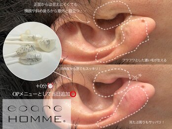エサージュオム 銀座エスト店/耳毛WAX★当日追加OK