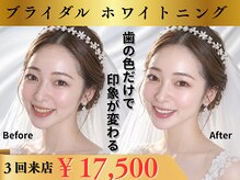 エヌエーホワイトニング たまプラーザ店(NAホワイトニング)