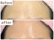 ヒール(heal)/症例