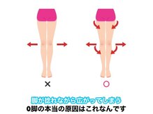 タスク整体院/O脚の本当の原因