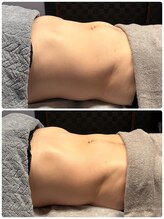 ロザリー(ROSALY)/腸もみＢ＆Ｆ