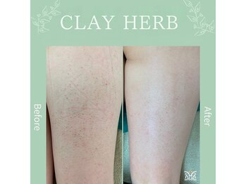 ダイヤモンド リーエンダ(Diamond leende)/クレイハーブピーリングBODY