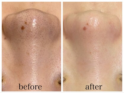 アリエスの写真