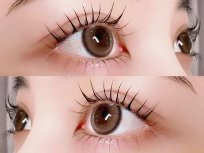 リリーフ(Relief)の写真