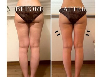 ヨサパーク ハグ 北野(YOSA PARK hug)/短期集中ダイエット！