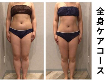 プラマイル(Pramile)/全身ケアコース