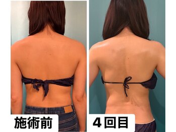 ページミューの写真/食事制限や運動では痩せにくいポッコリお腹でお悩みの方に☆腸もみで癒されながら溜め込んだ身体を大掃除!
