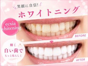 エクシアホワイトニング 東上野店の写真/【まずはお試しからでも大歓迎♪】セルフホワイトニング☆強力な自社開発ジェルの美白美容成分使用で効果◎