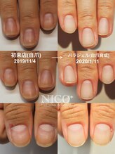 ニコプラス(NICO+)/パラジェルクリア補強