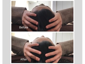 シュシュ(Chou chou)/【Before★After】ヘッドスパ