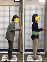 くすの樹接骨院/整体院 鳥栖院/整体/骨盤矯正ビフォーアフター