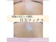 ルシアル(Rucial)の雰囲気（毛穴の大掃除に最適♪明石エリアで少数のフェイシャルワックス♪）