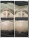 セルヴィノバ(CELL VI NOVA)の写真/今までにない感動ツヤ肌仕上げ◎剥離なして圧倒的な肌質改善結果!1年以上何をしても変わらなかったあなたへ