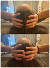 リモド(Rimodo509)/小顔矯正（ヘッドスパ