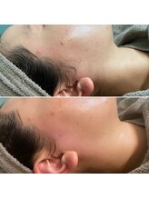 ナチュラヒルズ(Naturahills)/