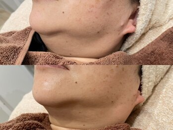 エミュ(emu)/レモンボトル2回目