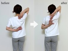 エーアール(AR)/【Before/After】2回目