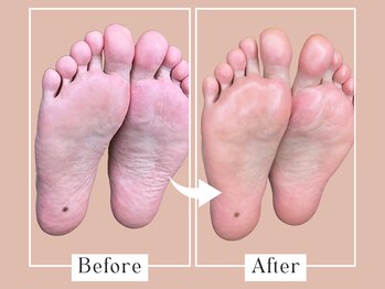 ベベ(Bebe)/40代女性/ガサガサお悩み