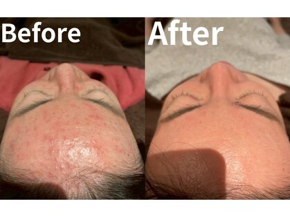 ビオラス(VIOLAS)の写真