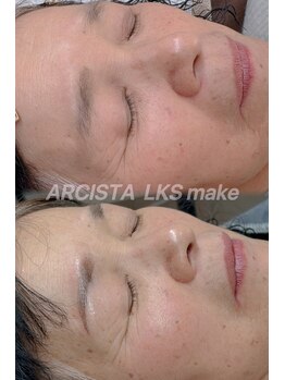 アルシスタ(ARCISTA)/【LKSmake】