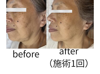 エヌ サロン(enu salon)の写真