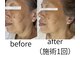 エヌ サロン(enu salon)の写真