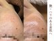 コモレビ(komorebi)の写真