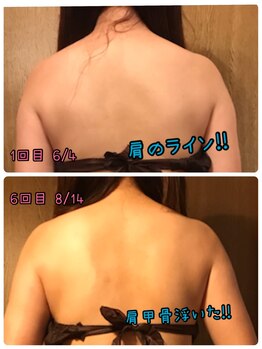 リーズサロン(REs.salon)/【40代】肩甲骨、肩のラインが！