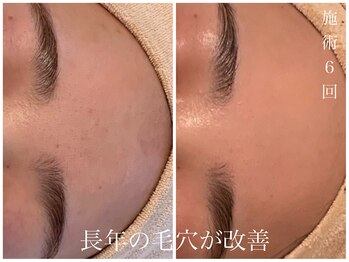 ダン(dan)/【陶肌トリートメント】症例