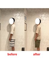 ナオル整体 福岡香椎院(NAORU整体)/30代男性施術事例【姿勢改善】