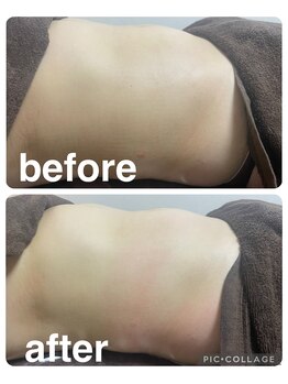 ギンザアール(GINZA R.)/ぽっこりお腹にアプローチ！