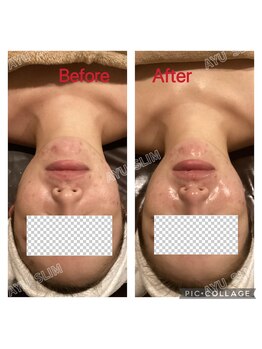 アユスリム(AYU SLIM)/一回でも変化できるの充実美顔
