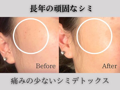 クリオ(Crio)の写真