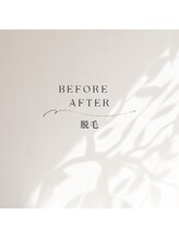 キザシ(kizashi)/男性には必ずしてほし髭脱毛☆