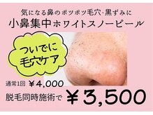 ザッツモア(That's More)の雰囲気（気になる「いちご鼻」に毛穴ケア！脱毛のついでにできちゃう）