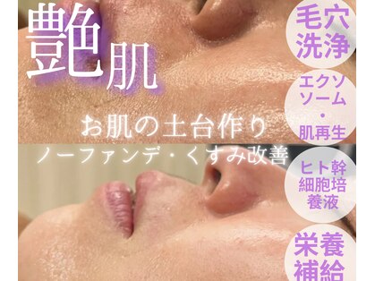 フォーシーズ(FOR SEEDS)の写真