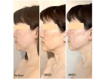 【たるみケア】血流・リンパ・姿勢、土台を整え引き上げる