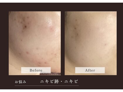 アディッシモ(addissimo)の写真