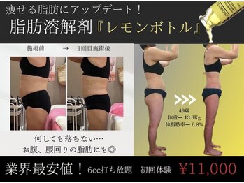 クリニカルエステ イーズ あべのキューズタウン店の写真/【効果◎韓国発脂肪分解液レモンボトル上陸¥11000】二の腕/お腹/背中/腰肉/ヒップ/太ももに徹底アプローチ
