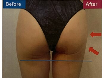 アンフィニ(infini)/短期集中コース