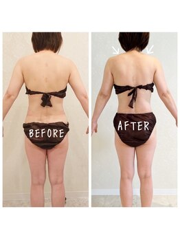 デジール(DESIR)/背中スッキリ☆