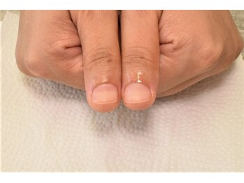 リリー(Lilly)の写真/《深爪ケアに特化したメニューご用意◎》当店は爪の健康を第一に考えているネイルサロンです♪