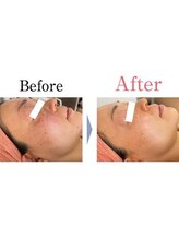 ビューティースパ/肌がワントーン明るくなる♪