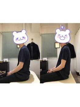 蕨整体院/猫背/姿勢矯正/骨盤矯正/蕨/整体