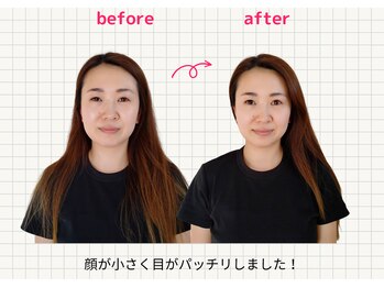 ナチュラルハリー(NaturalHarry)/当サロン自慢の経絡小顔施術!
