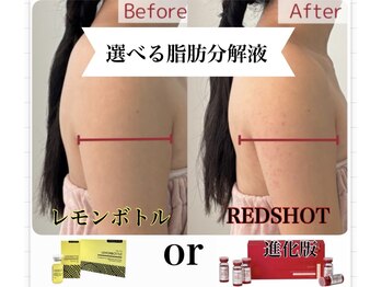 ハッピーエンジェル(Happy Angel)/レモンボトル or 進化版REDSHOT